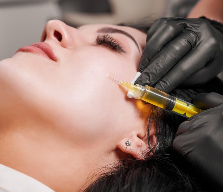 PRP Skin Rejuvenation