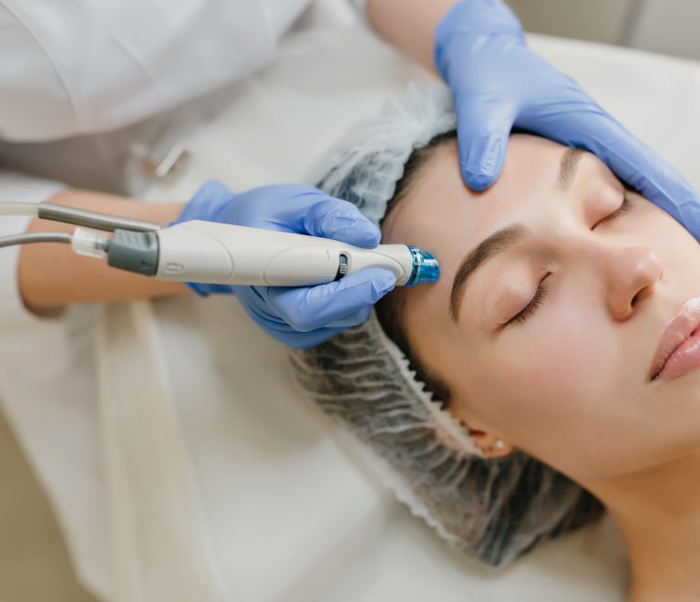 Microneedling
