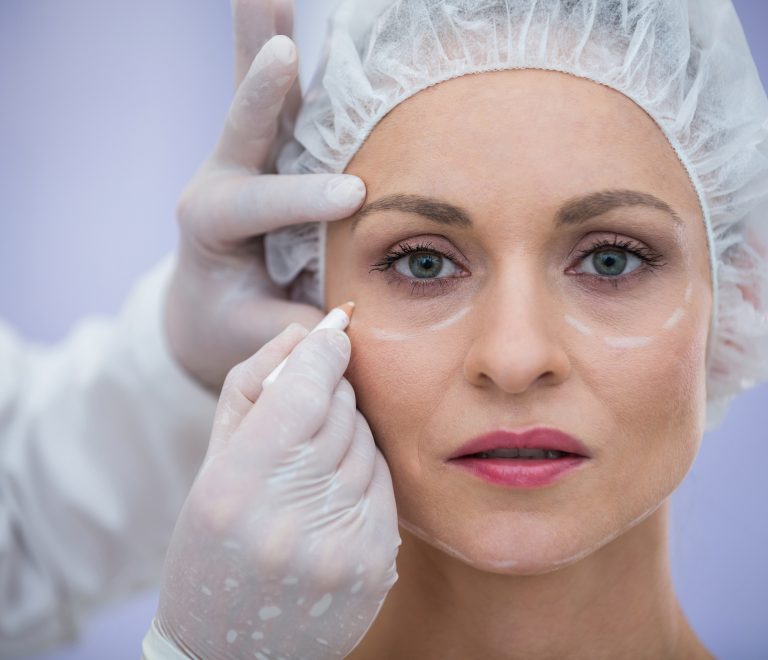 Under Eye Rejuvenation