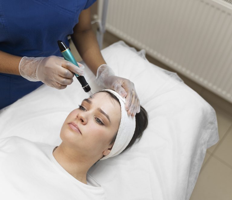 RF Microneedling