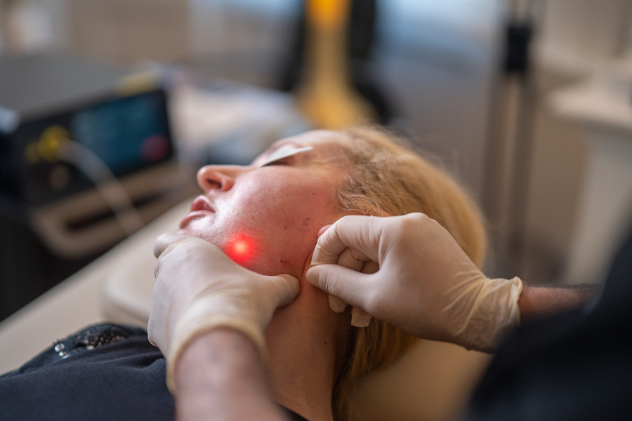 Endolaser skin tightening treatment on the jawline