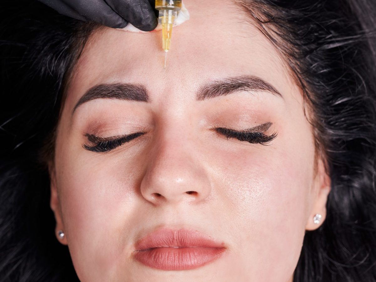 Plasmolifting procedure injection. Plasma injection into skin on forehead of patient. Macro photography. Top view. Concept of rejuvenation, health, beauty procedure and skincare treatment.